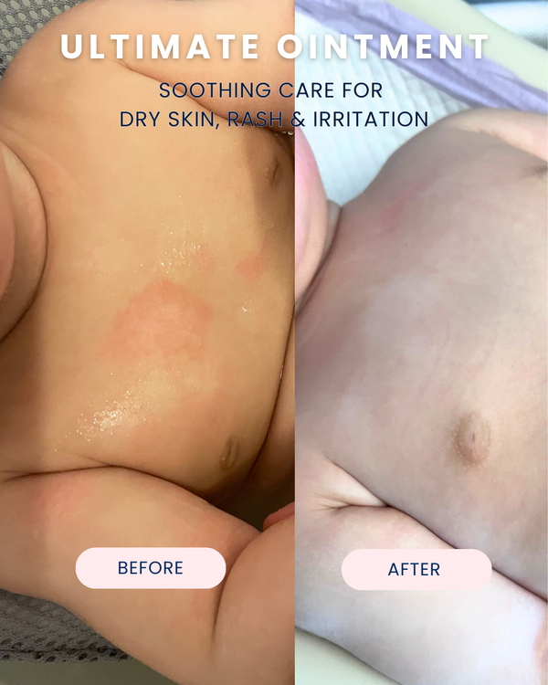 Ultimate Ointment, 3.4 oz - Magpies Paducah