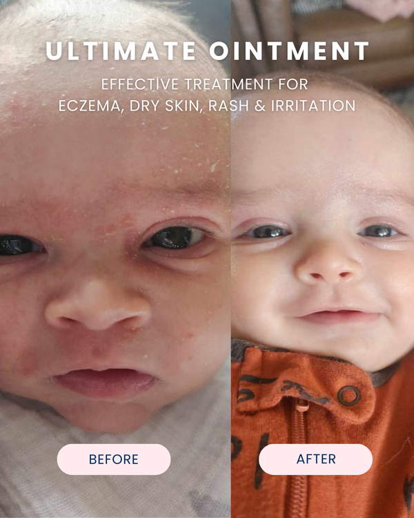 Ultimate Ointment, 3.4 oz - Magpies Paducah