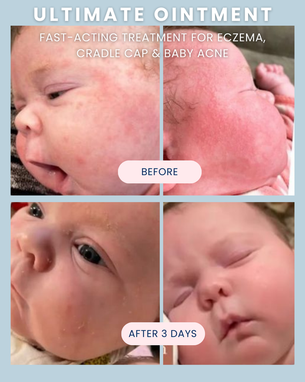 Ultimate Ointment, 3.4 oz - Magpies Paducah